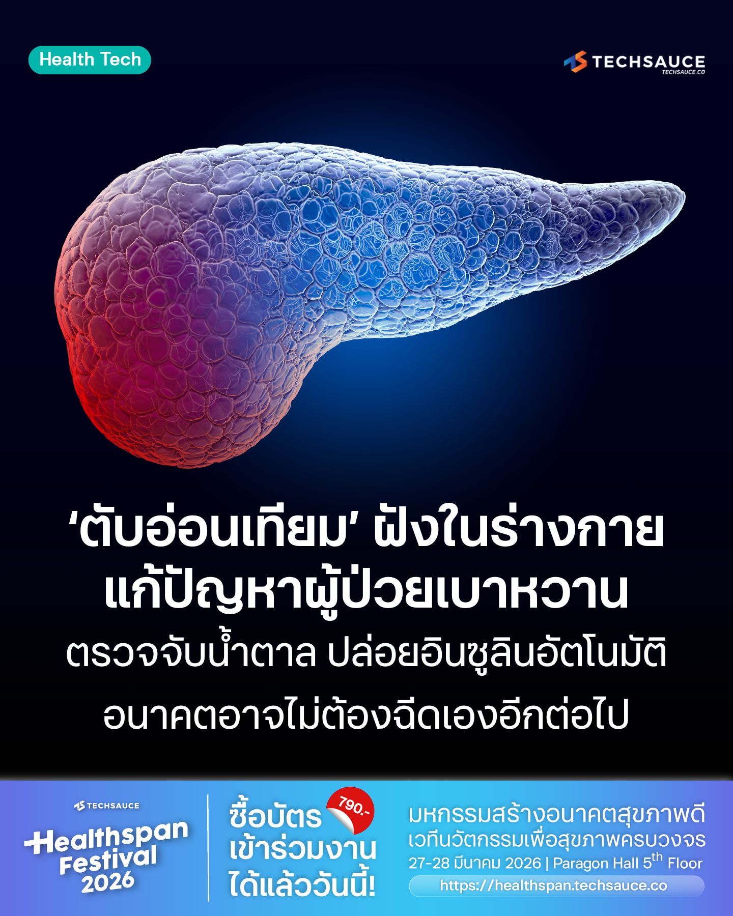 Techsauce - หากจะพูดถึงความทรมานของผู้ป่วยโรคเบาหวาน หนึ่งใน Pain Point ...