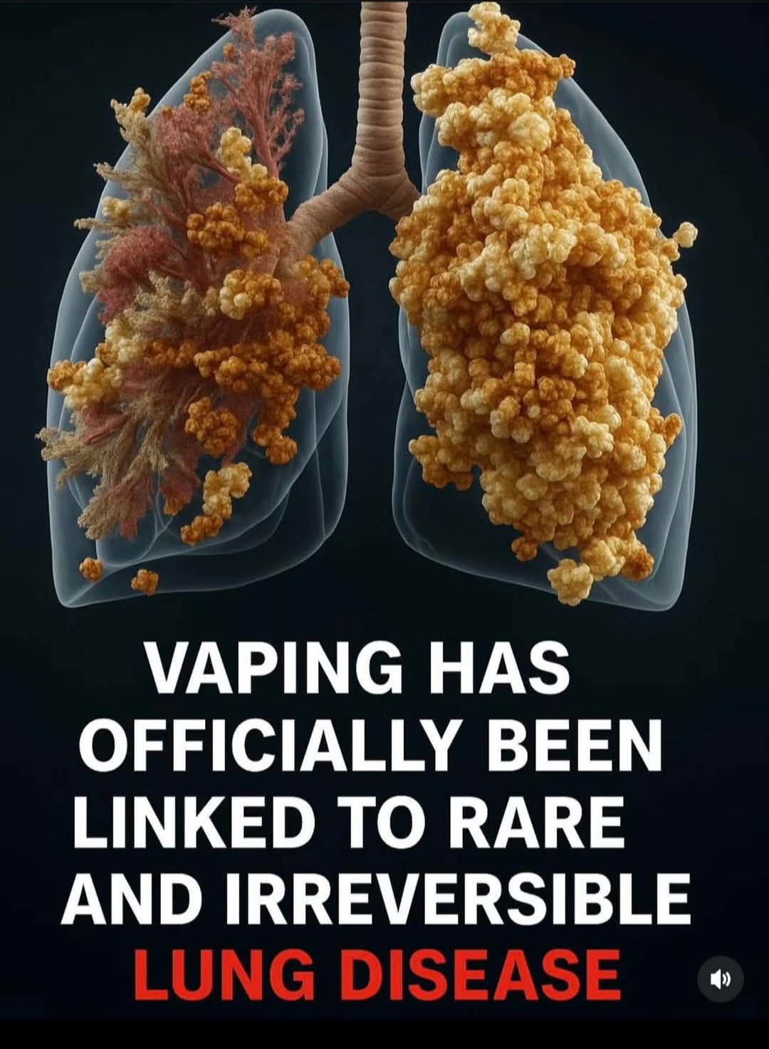 Just because it's flavoured doesn't mean it's safe.” Vaping can cause  popcorn lung, addiction, and increases the risk of heart attack and stroke.  Protect your health. Choose to be vape free !!! #