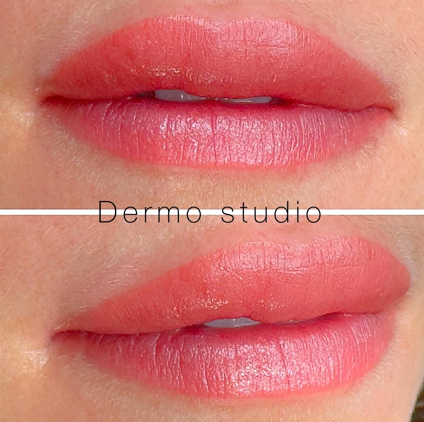 Dermographe Pour Maquillage Permanent France Dermo Skinflex L - Neuf, Origine France