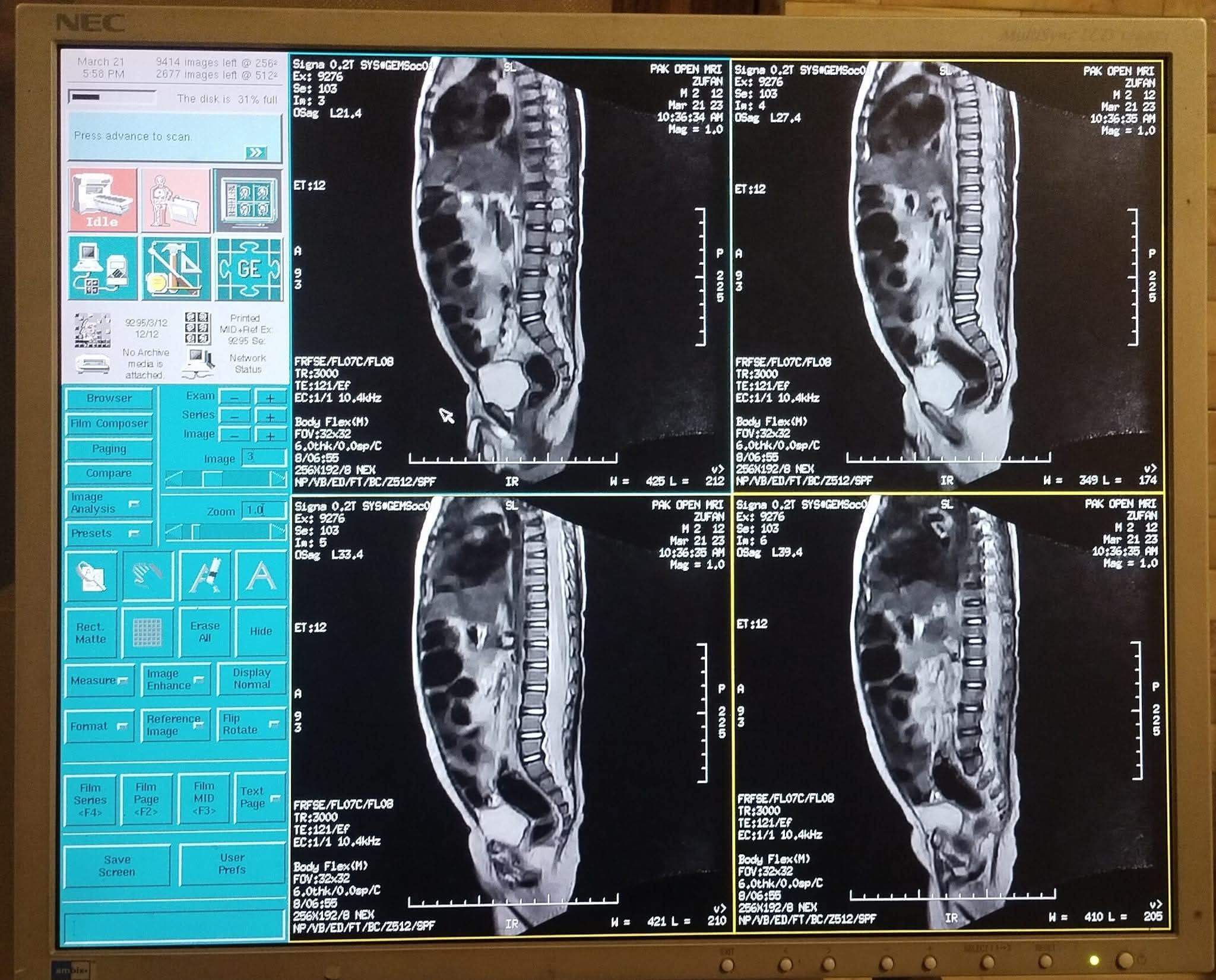 PAK OPEN MRI | Peshawar