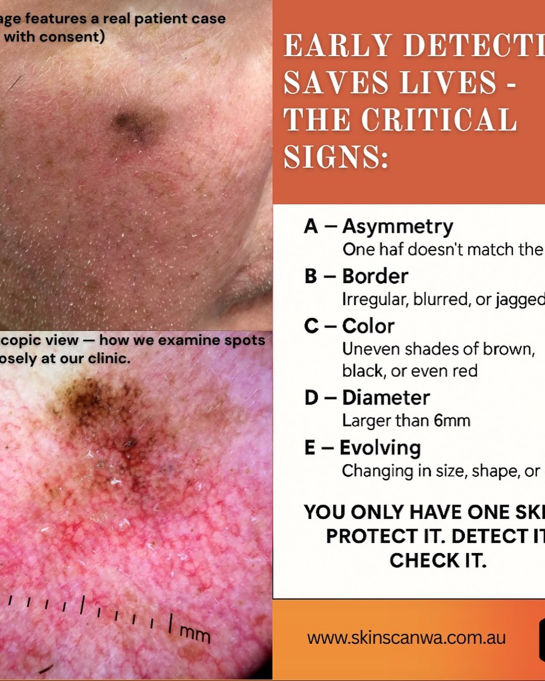 Skin Scan | Perth WA