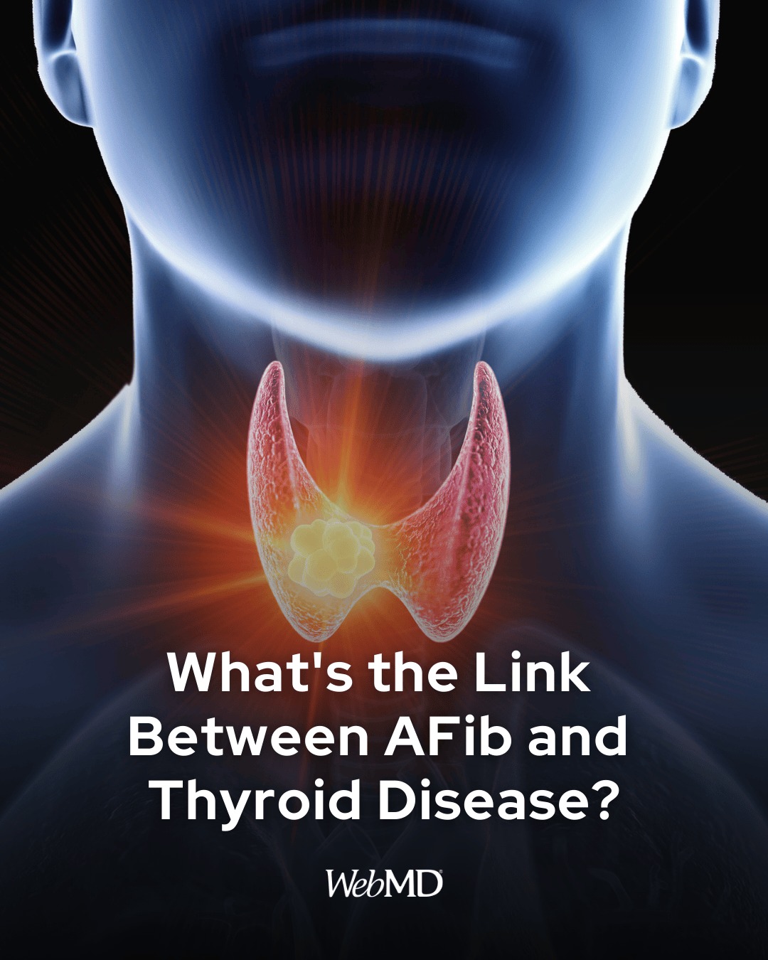 WebMD - There's a greater link between atrial fibrillation... | Facebook