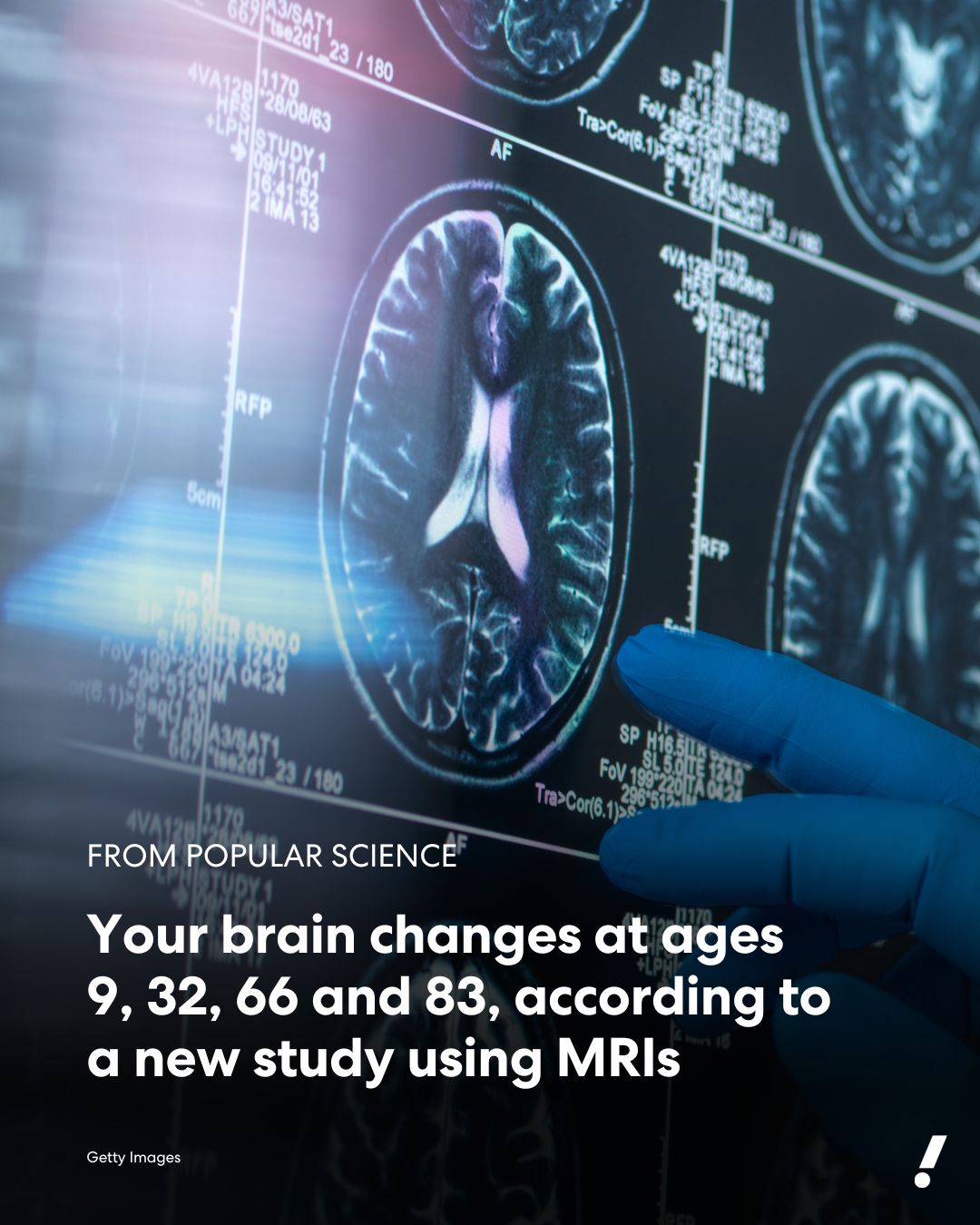 Yahoo - A team of neuroscientists identified five broad phases of brain ...