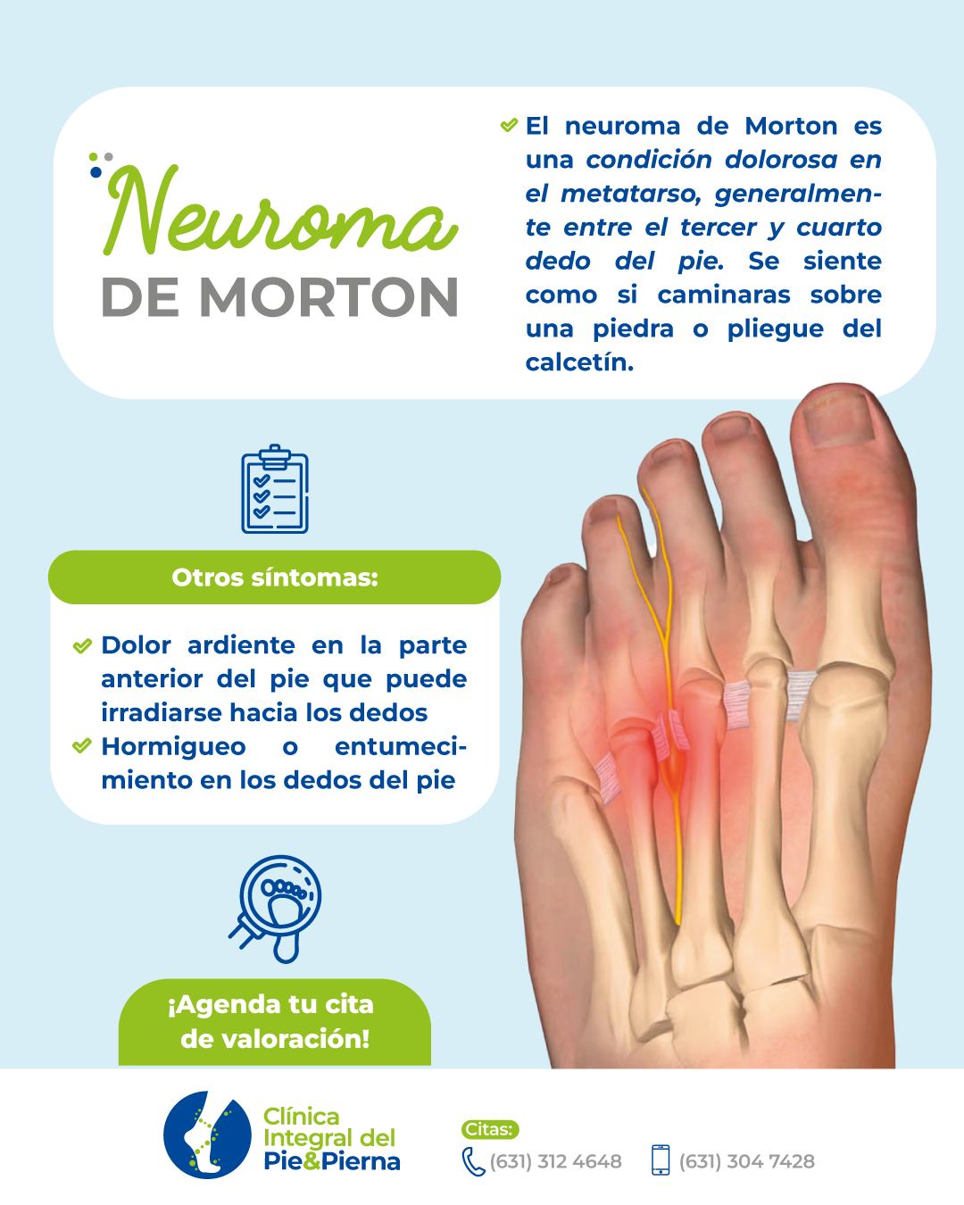 Clínica - 🦶 ¿Sientes dolor en la parte delantera del pie, como si ...
