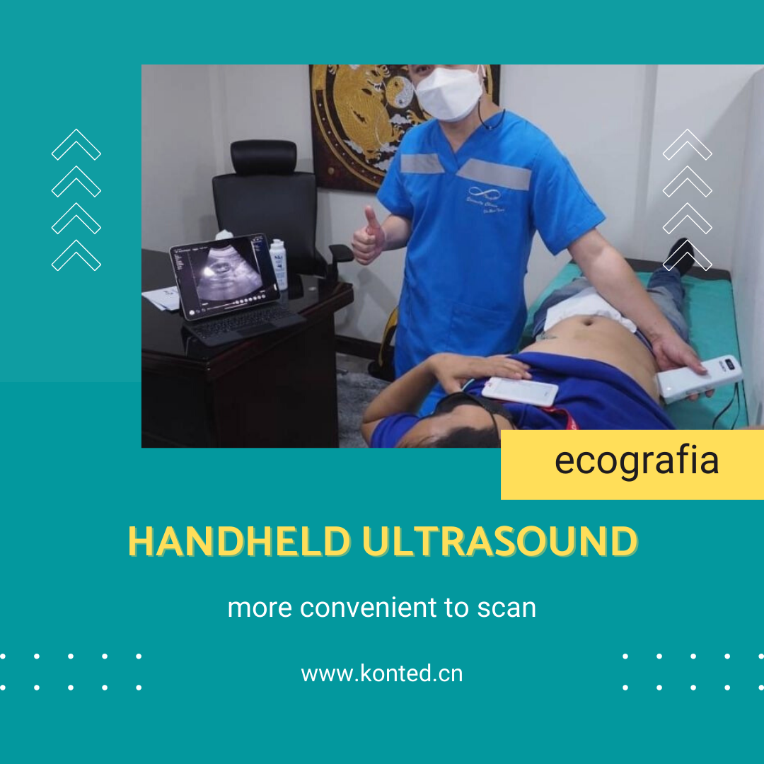 Konted C10TX provides excellent imaging quality, and the software can ...