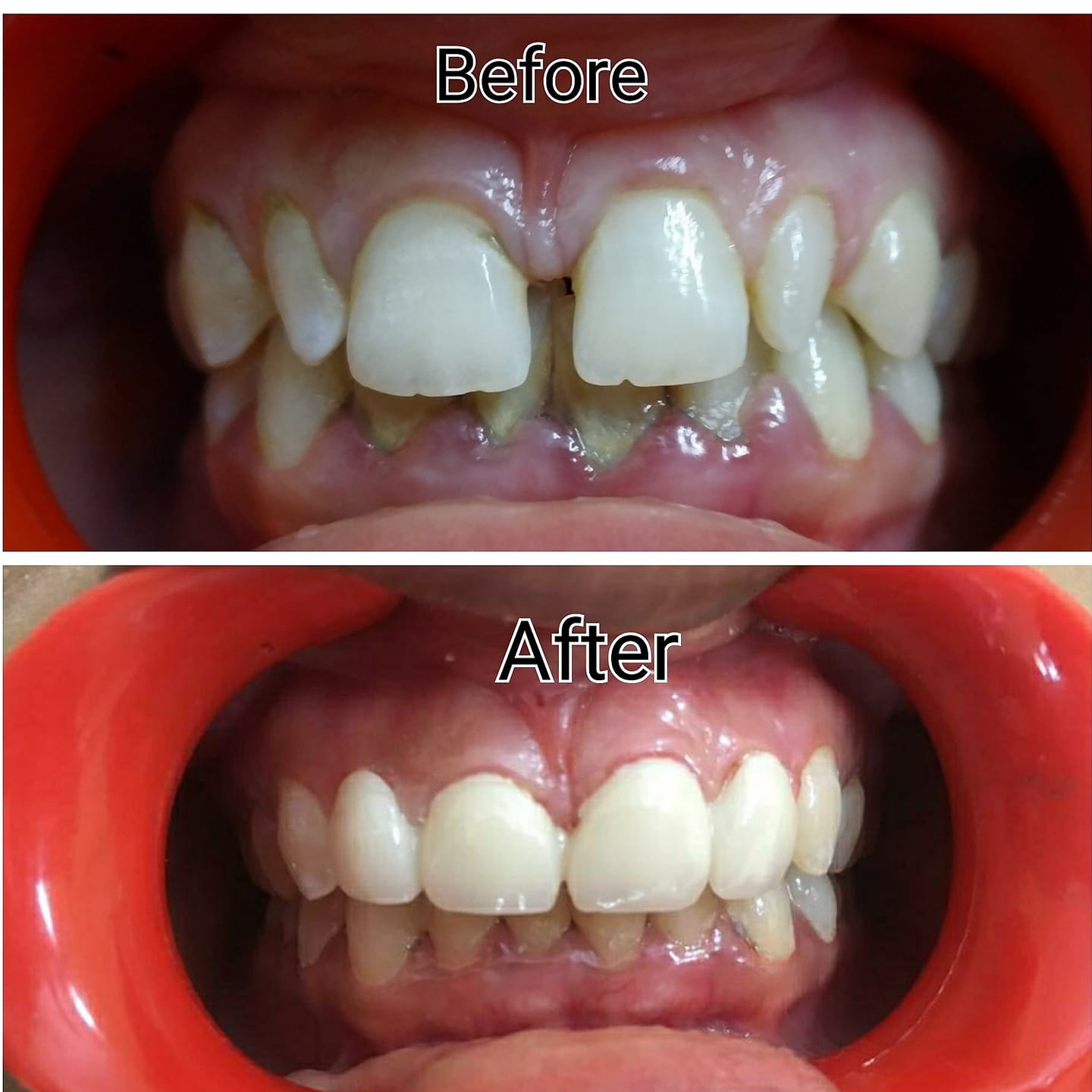 Guna's Dental care Pedappai