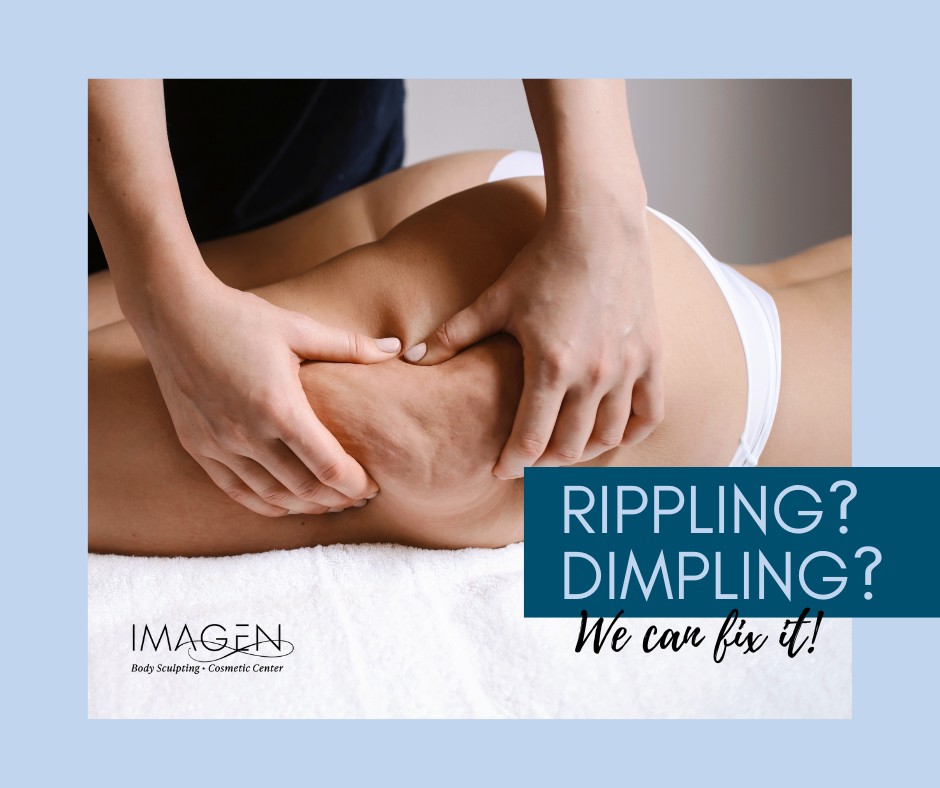 Imagen - Rippling? Dimpling? We can fix it. Cellulite isn’t just about ...