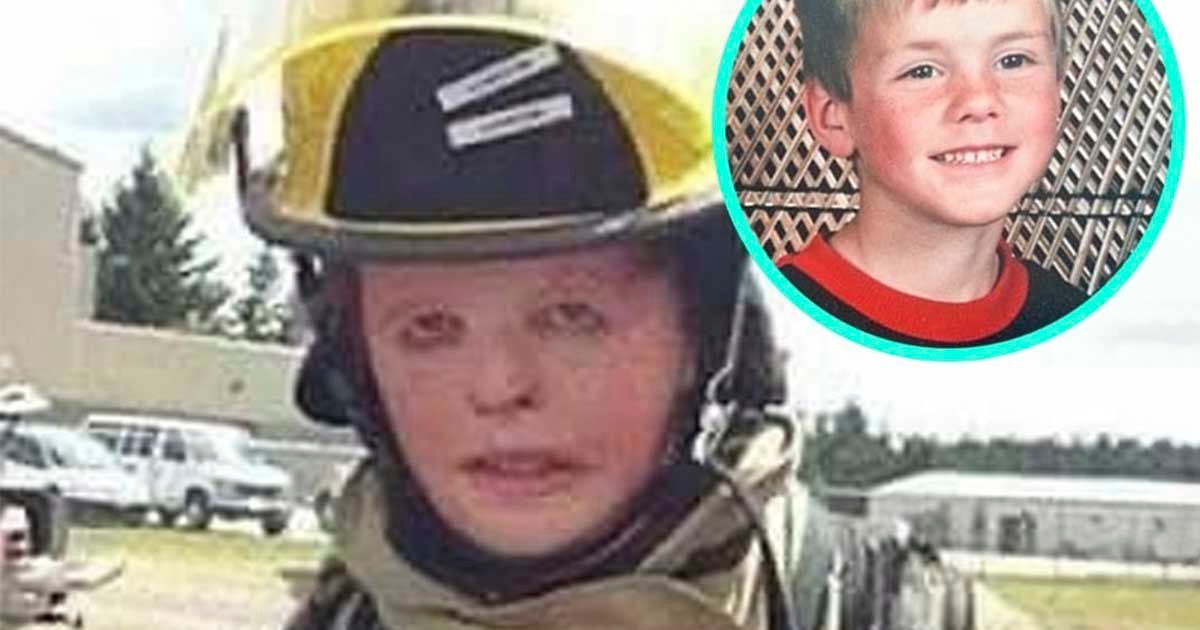 The Breast - Boy Who Suffered 3rd-Degree Burns When He Was 6-Years-Old ...