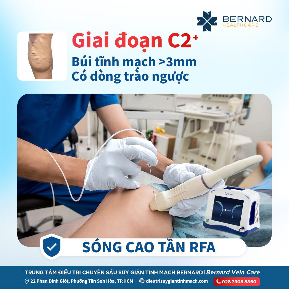Điều trị Suy giãn tĩnh mạch | Ho Chi Minh City