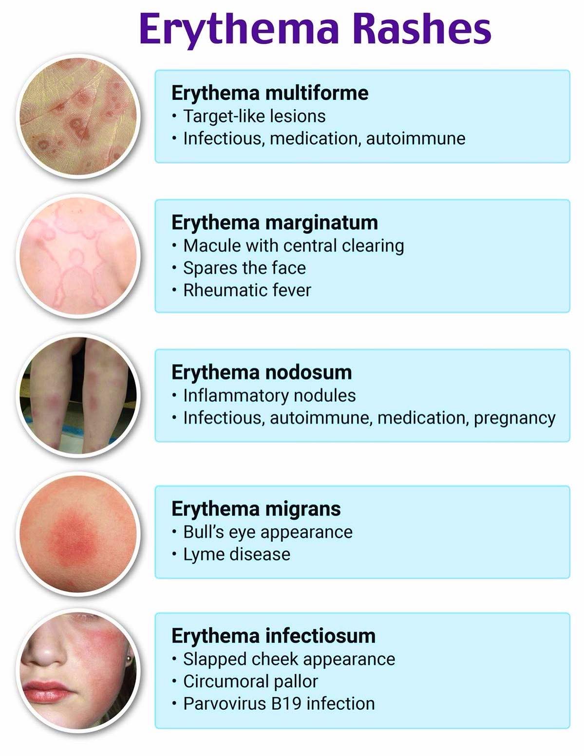 MedPic - Erythema Rashes: Quick Review | Facebook