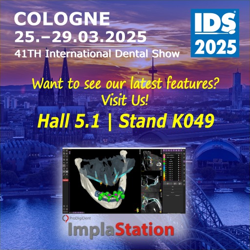 ImplaStation