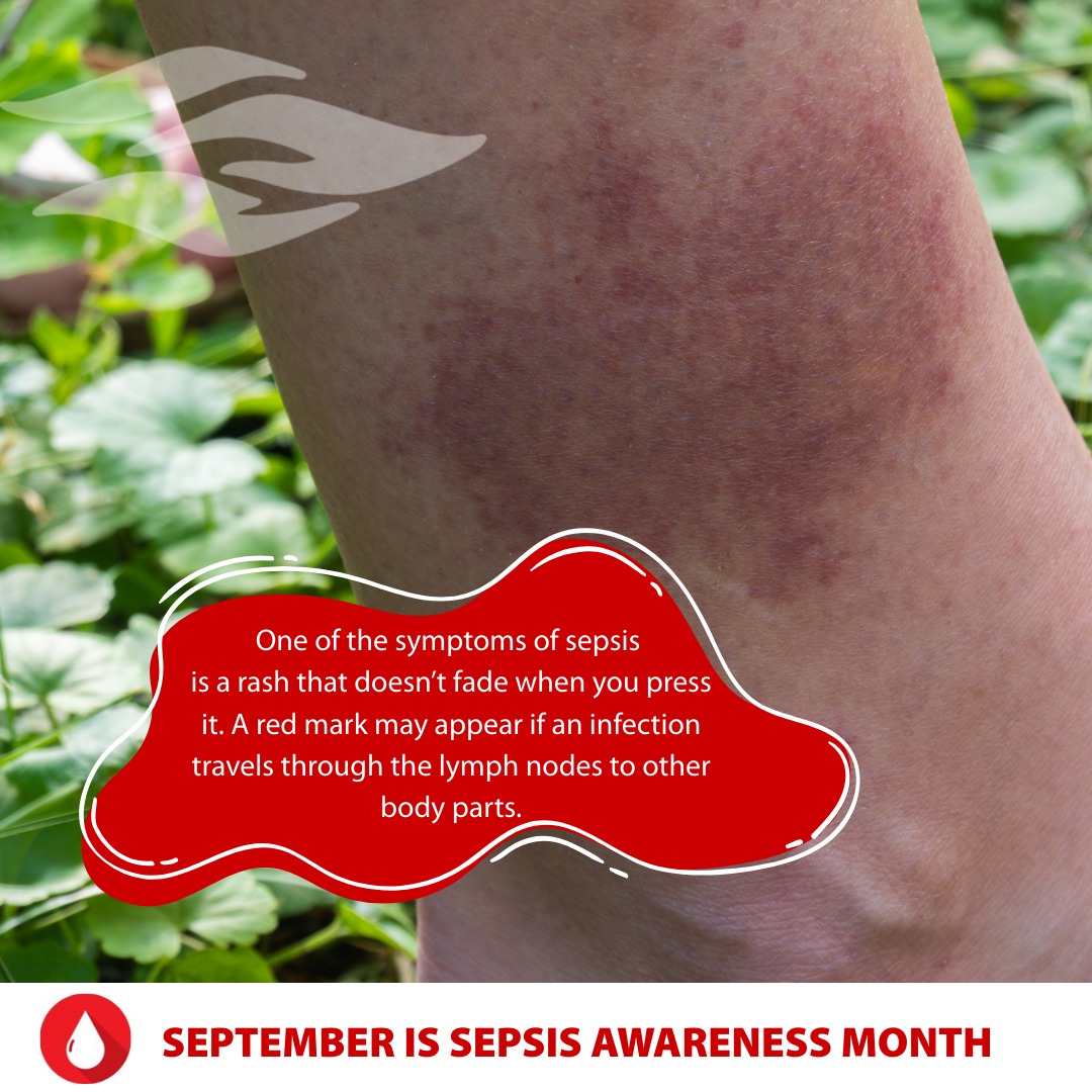 Riverside - September is Sepsis Awareness Month! Sepsis is a ...