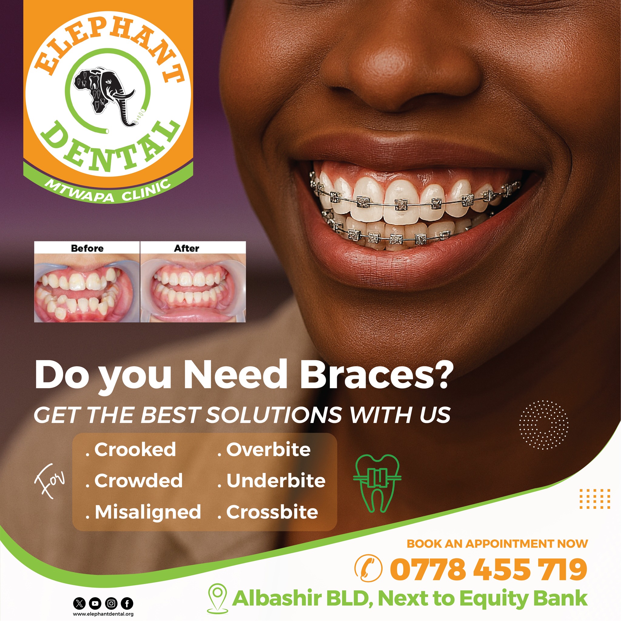 Elephant Dental Mtwapa | Mombasa