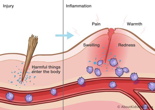 AboutKidsHealth - When an injury occurs, the cells of our... | Facebook
