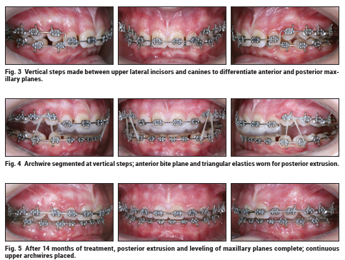 JCO - Journal of... - JCO - Journal of Clinical Orthodontics