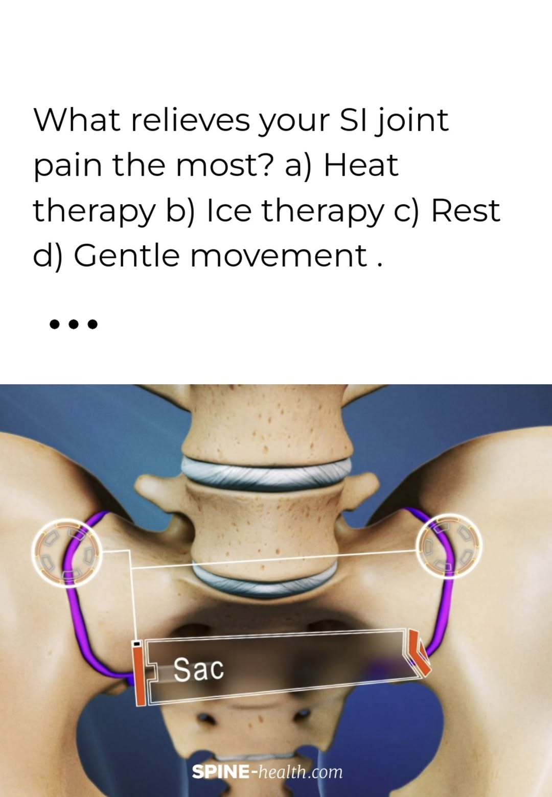 Spine-health | Facebook