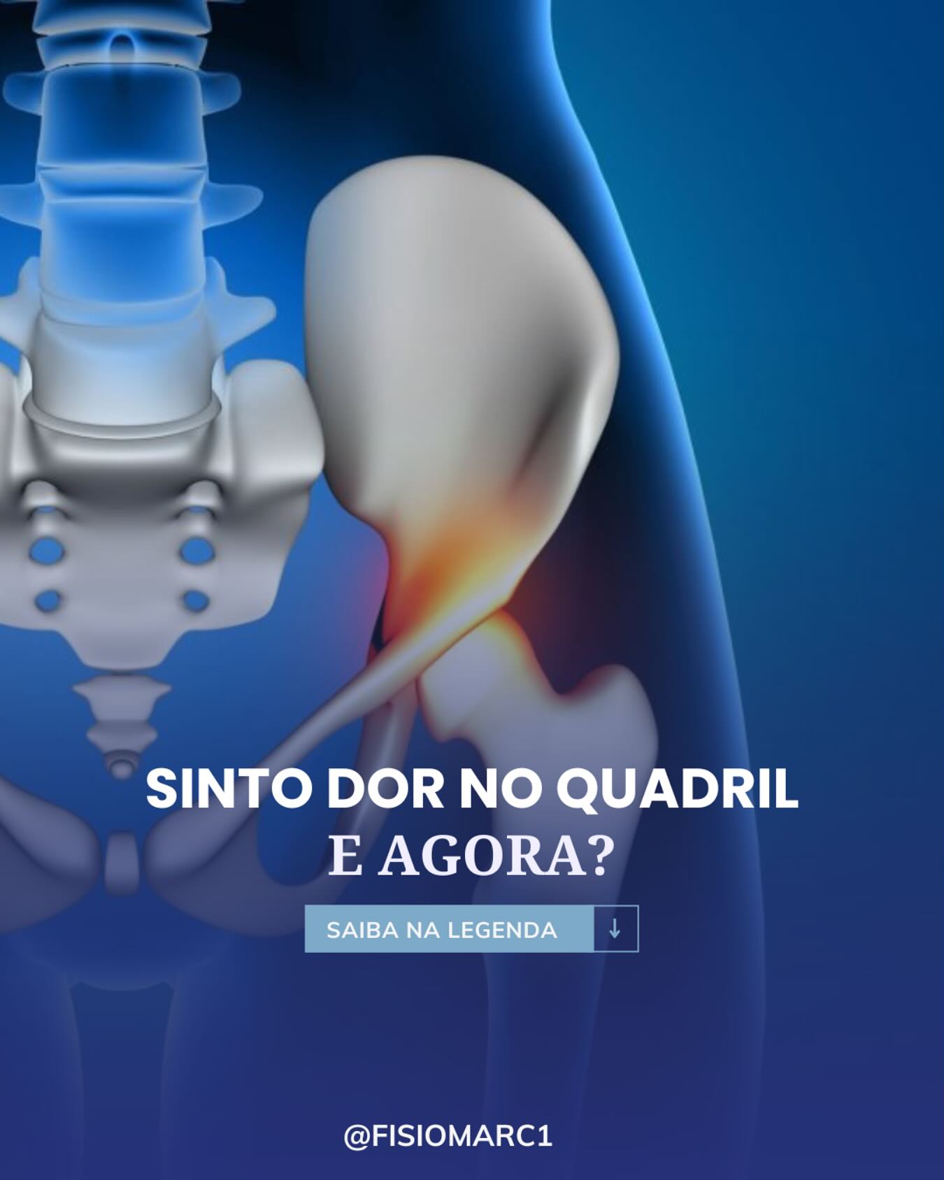FisioMarc - 🔹 A dor no quadril pode ter várias causas, e entender a ...