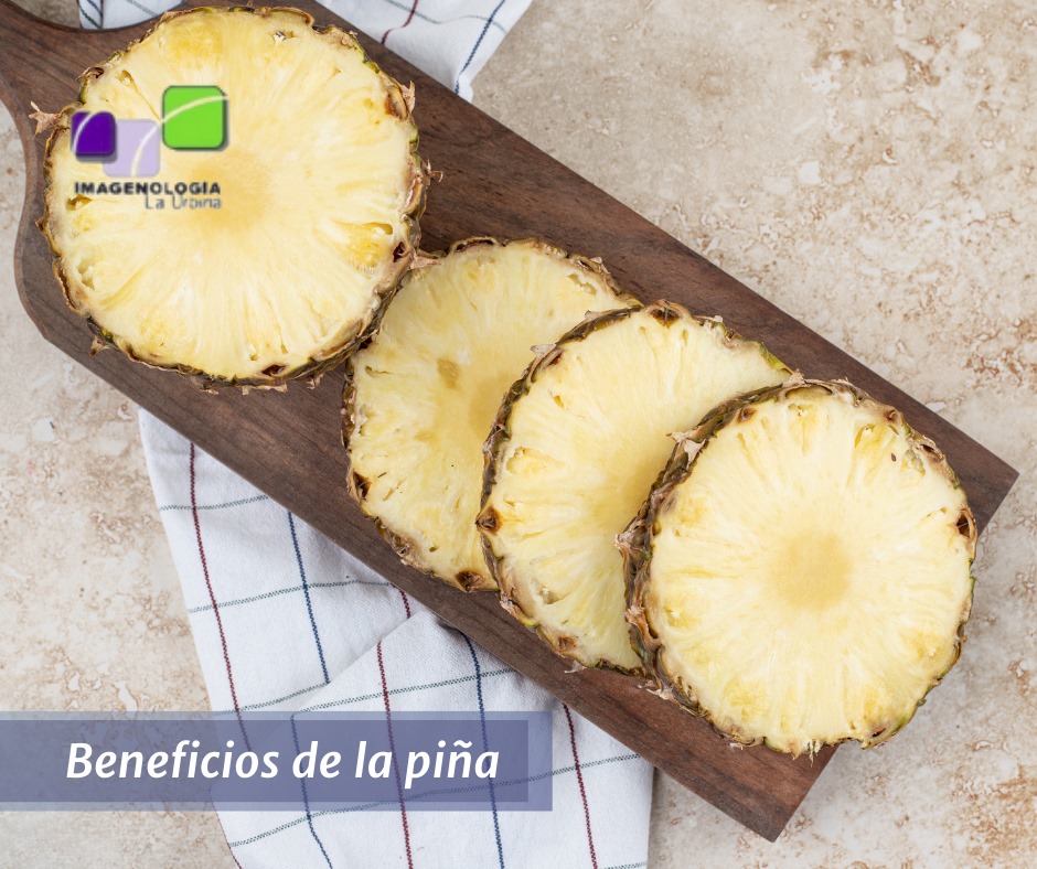 La piña es una fruta tropical... - Centro Clinico La Urbina