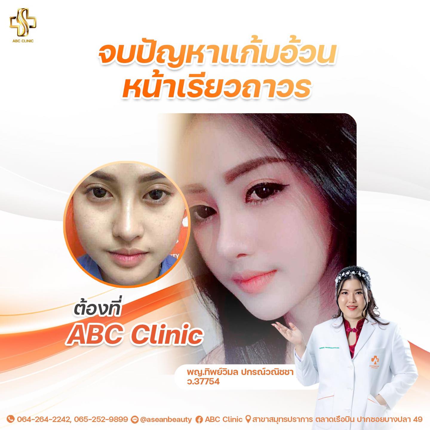 ABC - จบปัญหา “แก้มอ้วน” หน้าเรียวถาวร👩 ต้องที่ ABC Clinic👍 จากหน้า U ...