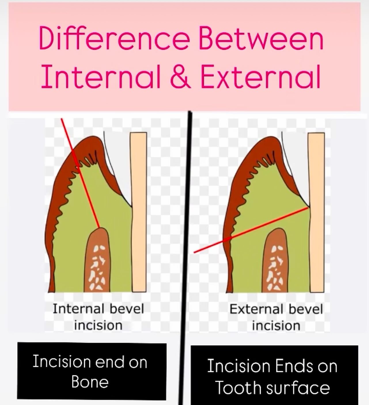 Difference between Internal and... - DR Mohini D. Daultani | Facebook