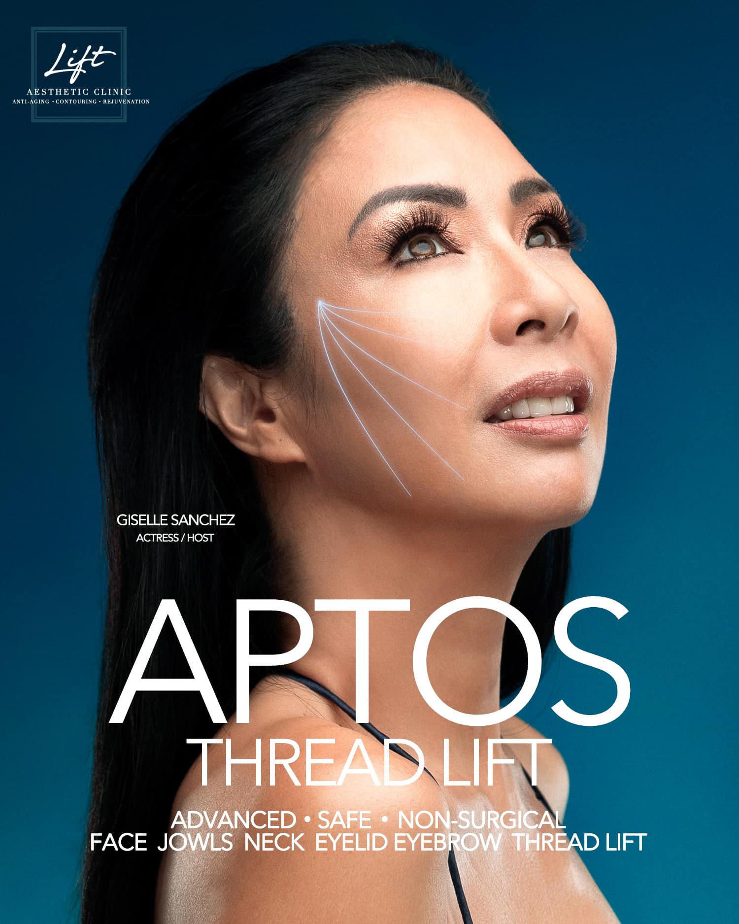 Lift - Aptos Thread Lift Advanced • Safe • Non-surgical Face Cheeks ...