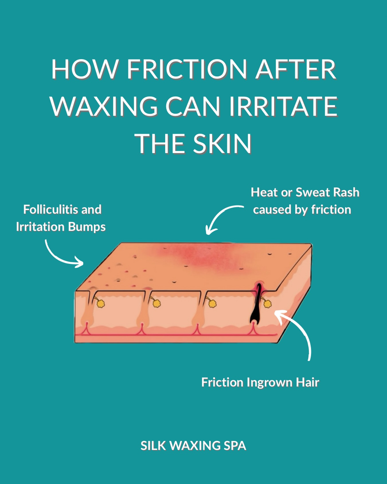 Silk Waxing Spa | Berlin CT