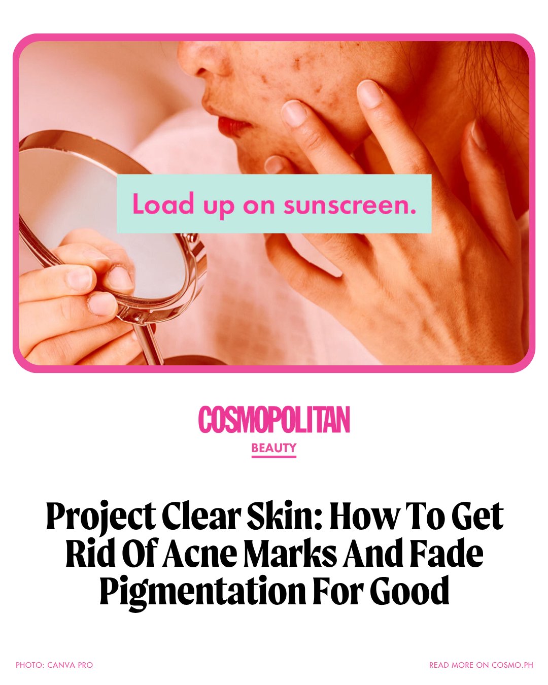 cosmo skin glutathione cause pimples Banishing is only half the battle. If the dark spots on your face were marks that acne has left behind, check out the comments for the things you should do to CAS 89030-95-5