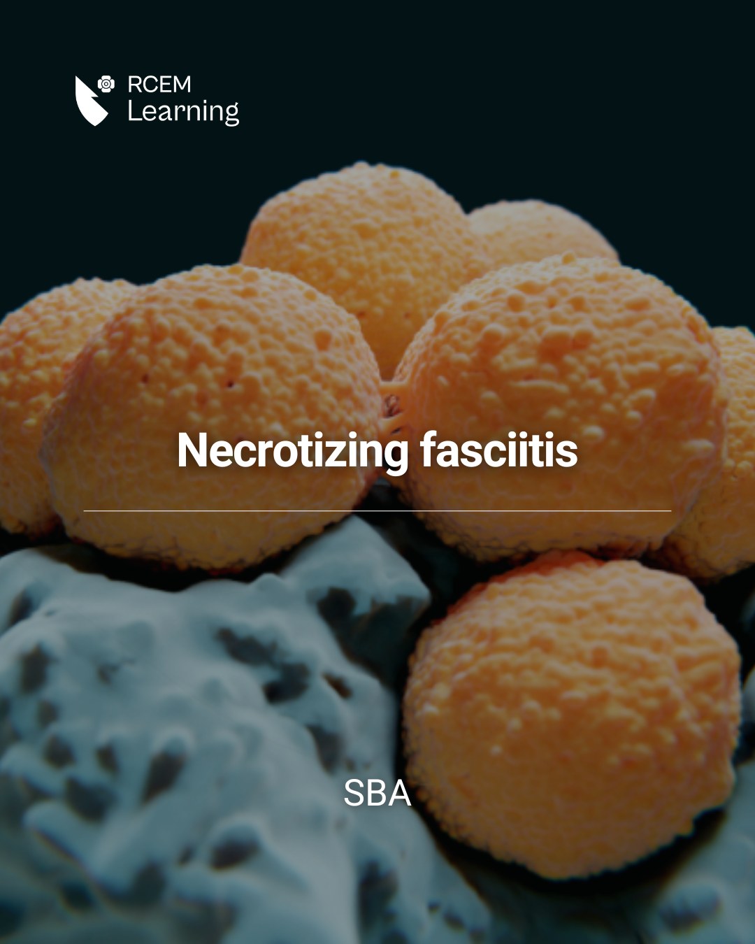 RCEMLearning - UPDATE: A painful rash and a febrile... | Facebook
