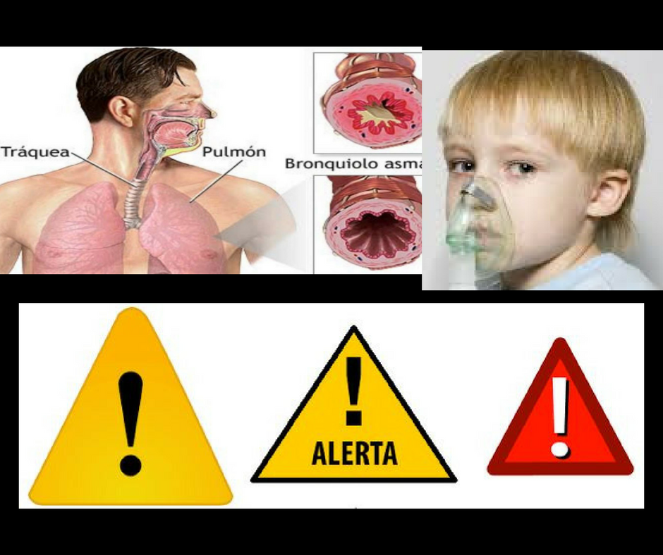 Tus Servicios Y Productos - SI PADECES DE ASMA, GASTRITIS, MIGRAÑA ...