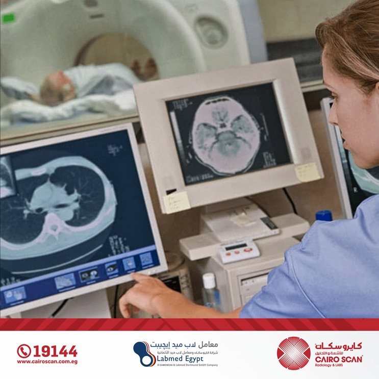 الان في كايرو سكان الرنين... - Cairo Scan Radiology&Labs | Facebook