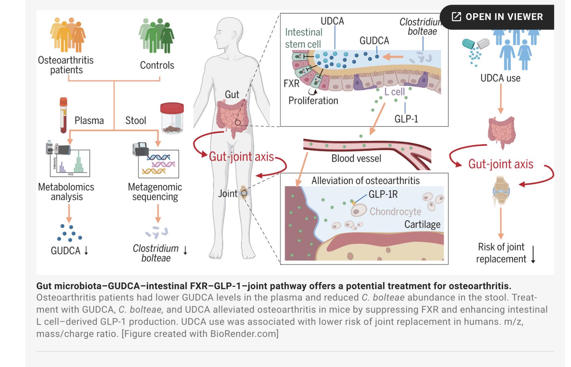 Osteoarthritis treatment via glp-1–mediated gut-joint axis targets intestinal fxr signaling