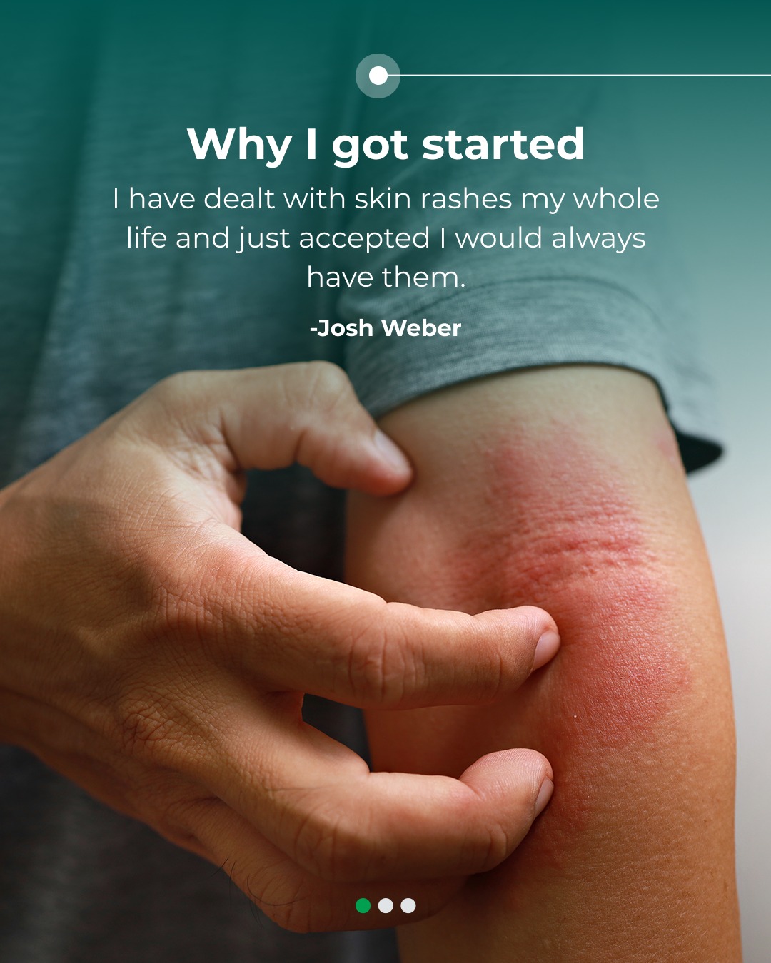 Decades of rashes solved in one week. 🤯 Josh had accepted his skin rashes as a permanent reality...until he got the data. His results revealed an unexpectedly high Vitamin B12 level, which