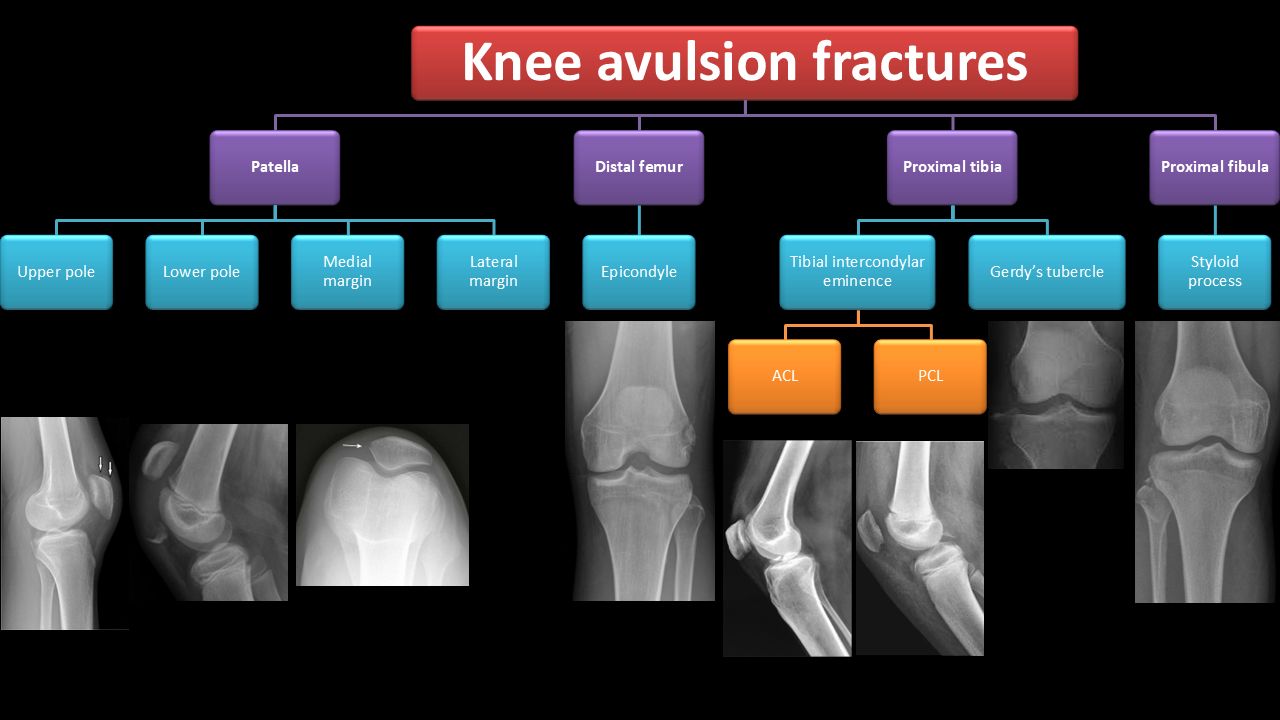 Dr/Hytham... - Dr/Hytham Nafady - New Approach to Radiology