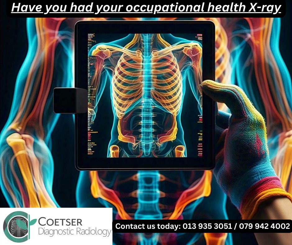 Coetser Diagnostic Radiographers Witbank/Emalahleni - ☢ 🦺The Importance ...