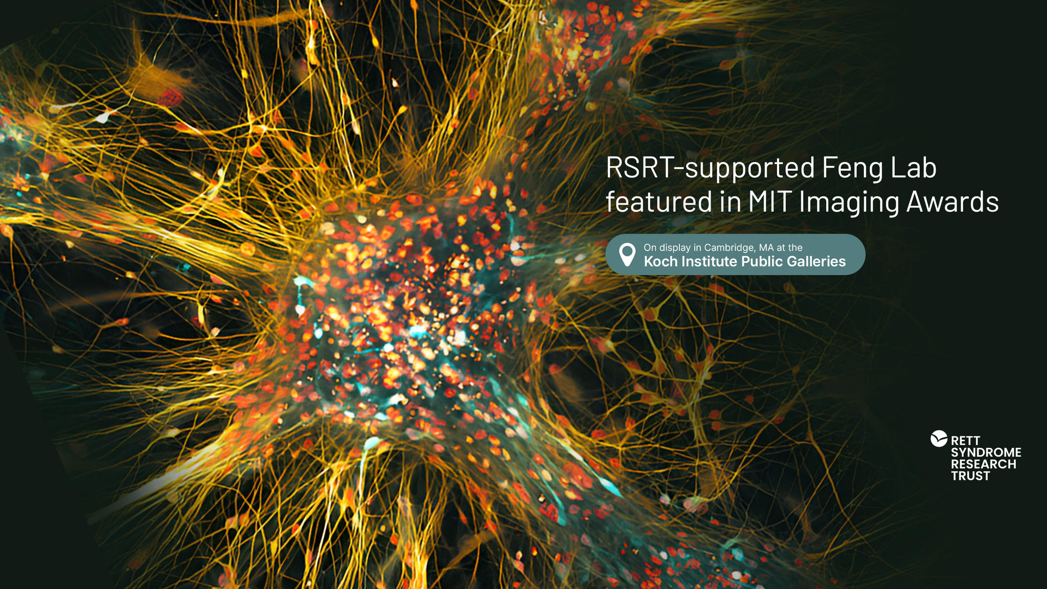 Rett - This image from the Feng lab at Massachusetts Institute of ...