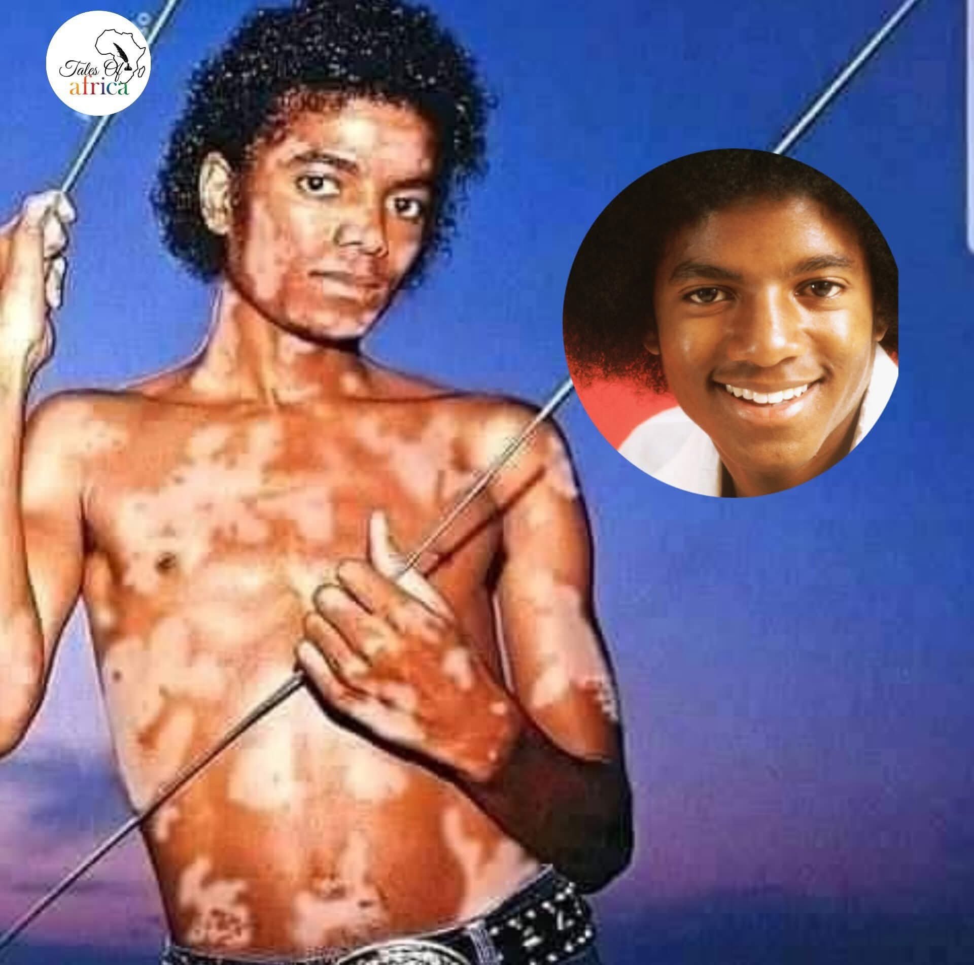 michael jackson glutathione DO NOT JUDGE IF YOU DO NOT KNOW THE WHOLE STORY. To this day, many assume bleached his skin to become white – that it was a wilful cosmetic decision Glutathione made in Canada GMP certified