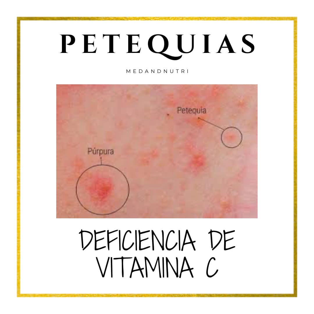 Medandnutri - 🍓La vitamina C, conocida también como ácido... | Facebook