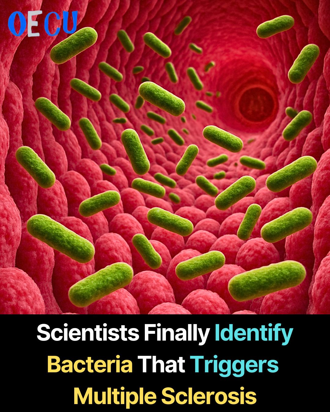 Only - In a major breakthrough, scientists have identified two gut ...