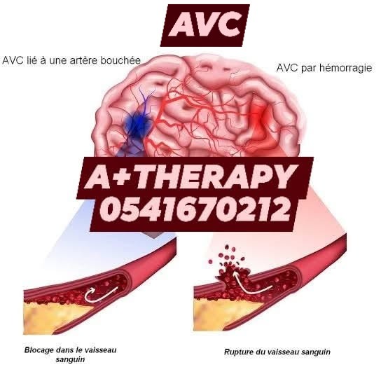 A+ Therapy | Algiers