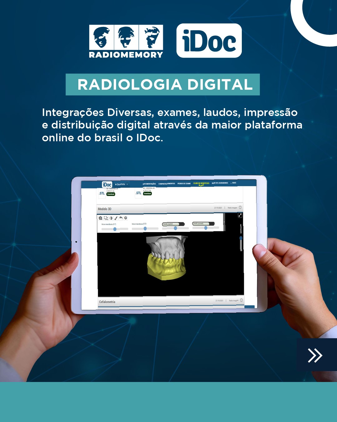 Radio Memory