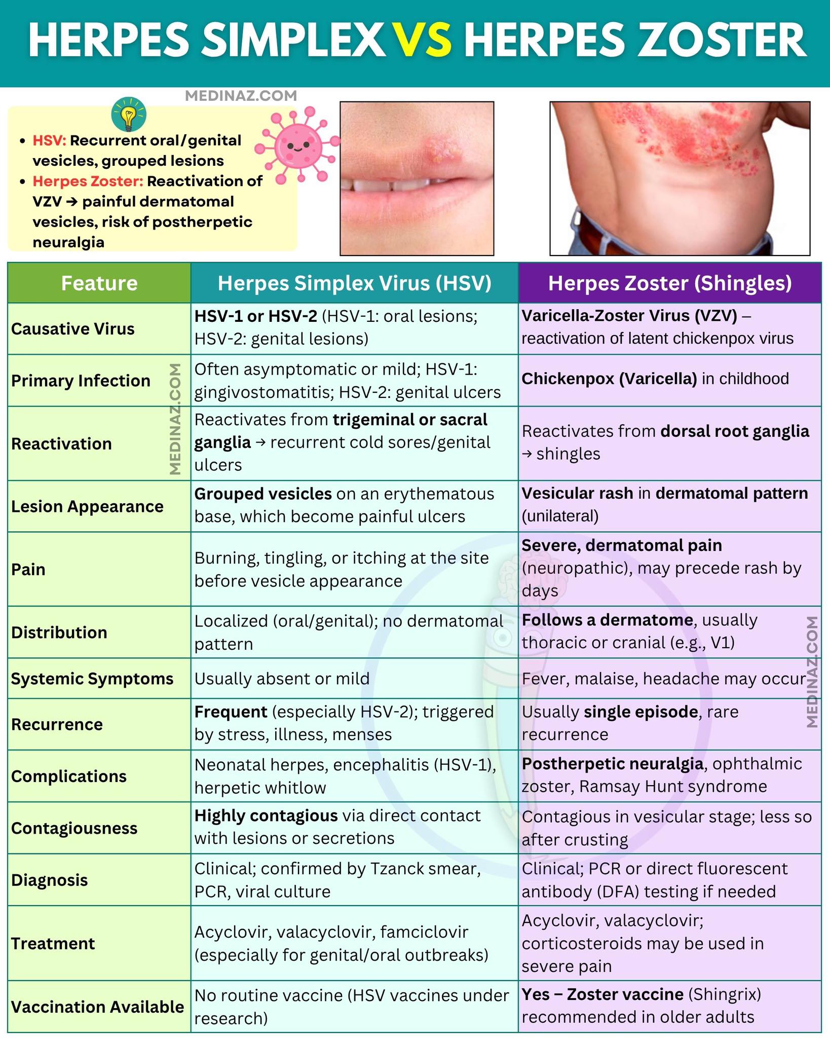 Medinaz - Herpes simplex Vs Herpes zoster | Facebook