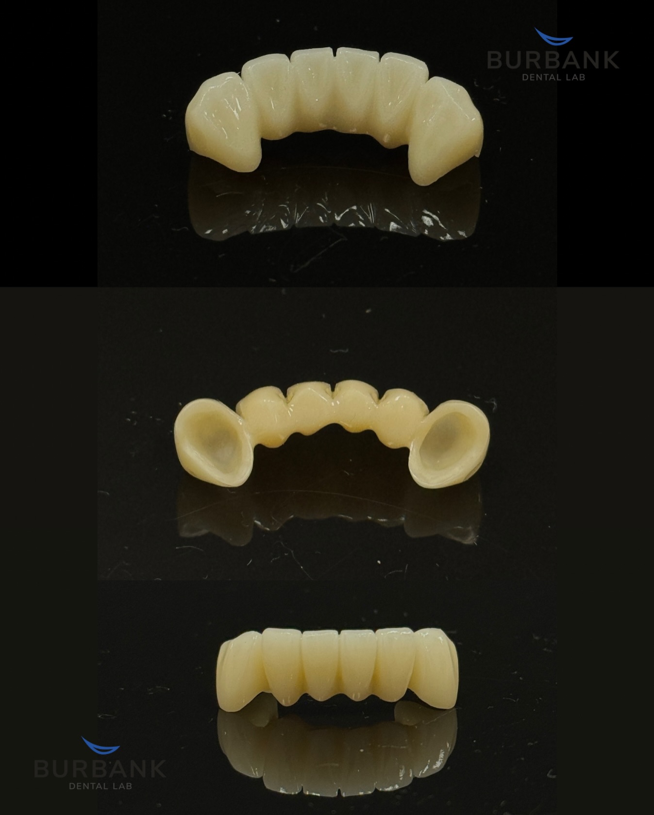 Burbank Dental Lab - Our Smile By Design team is dedicated to ...