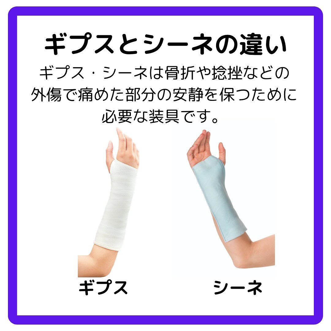シーネ 固定 と は
