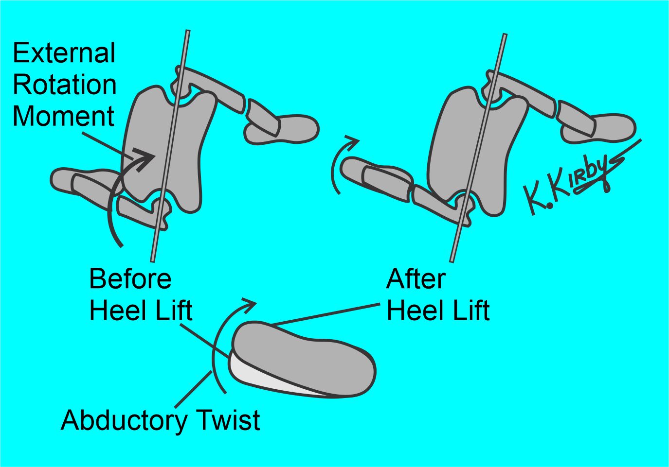 Ashfield Orthotics: A Foot Health Clinic | Regina SK