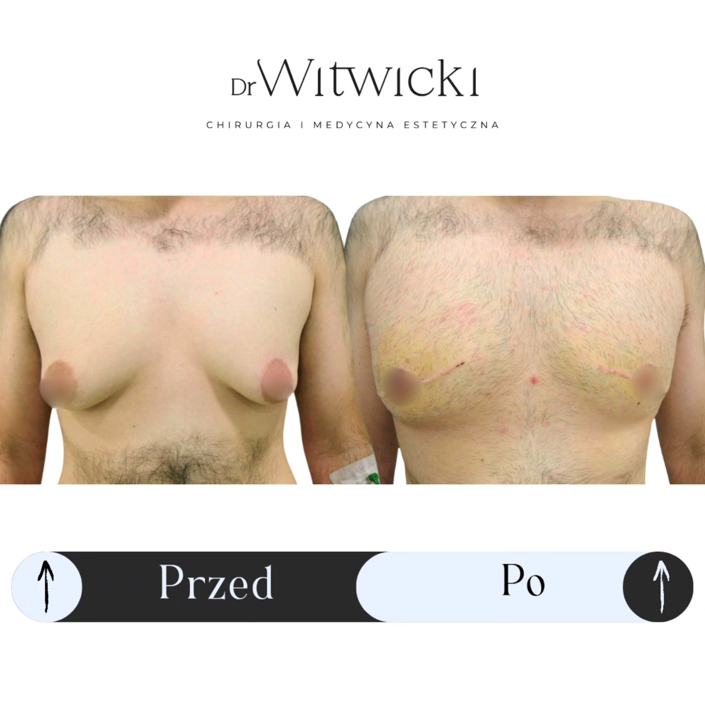 dr-witwicki-chirurgia-chirurgia-plastyczna-i-medycyna-estetyczna