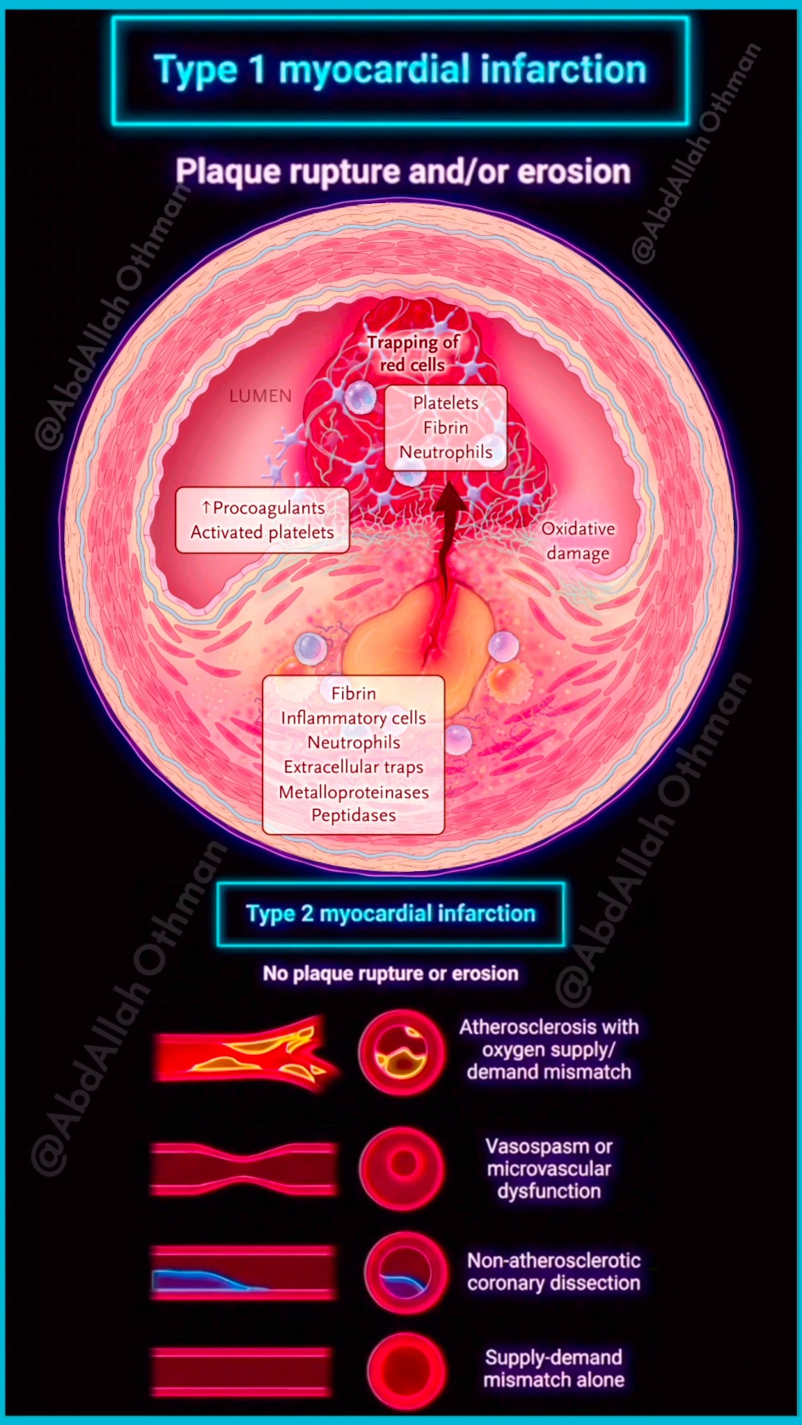 Human anatomy and physiology | MI means 1.Myocardial infection 2 ...