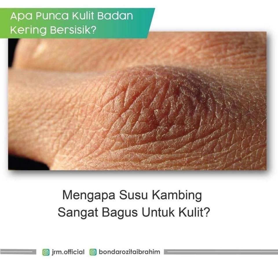 Jamu Ratu Malaya Sungai Besar Rb Kulit Kering Ni Kalau Dkt Muka Mmg Jelas Lah Nampak Keringnya Tapi Ramai Juga X Ambil Peduli Anggota Badan Yg Kering Yg Penting Mandi Bersih Dan Wangi Je