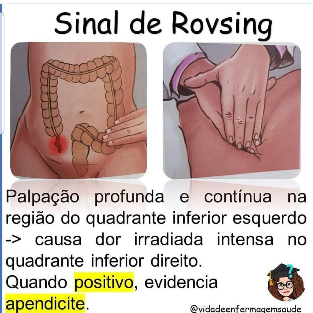 O sinal de Rovsing • Quando... - Somos Enfermagem Brasileira | Facebook