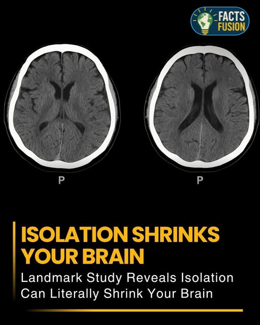 Facts - A groundbreaking study has revealed that prolonged social ...