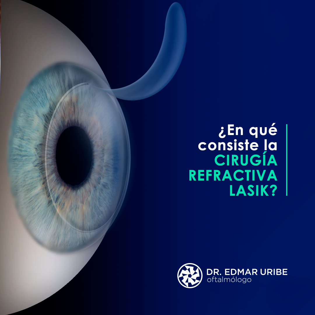 La cirugía LASIK es una de... - Dr. Edmar Uribe - Oftalmólogo | Facebook